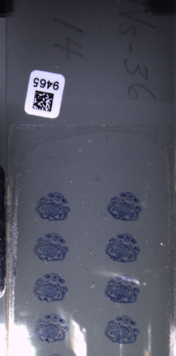 Media type: image; Special Collections 3102   shows specimen_part histological serial section;  Description: Whole slide scan, SC-3102, slide 14;